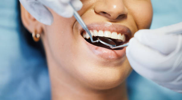Professional Emergency Dentist in SD